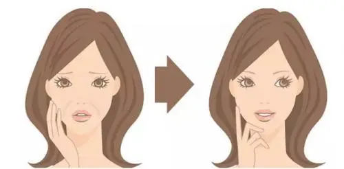 回春大作战，Sofiderm思伊美帮你重回元气满满的少女时代(图2)